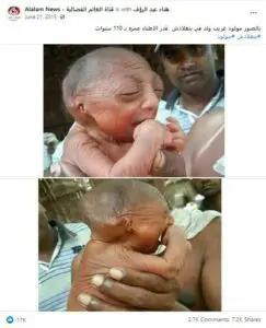 مصدر ادعاء ولادة طفل عمره 110 والصحيح أنه يعاني الشيخوخة المبكرة مضلل فتبينوا