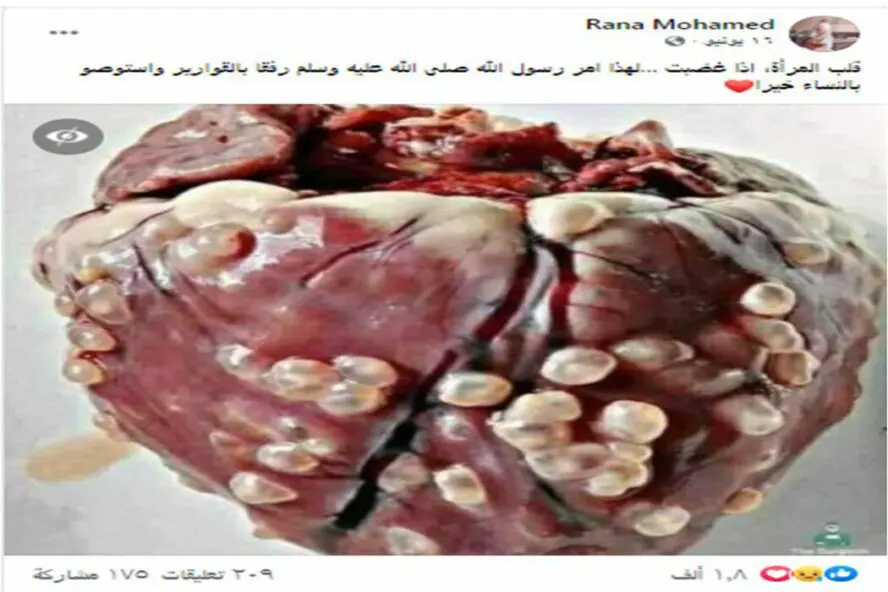 ادعاء قلب المرأة عندما تغضب