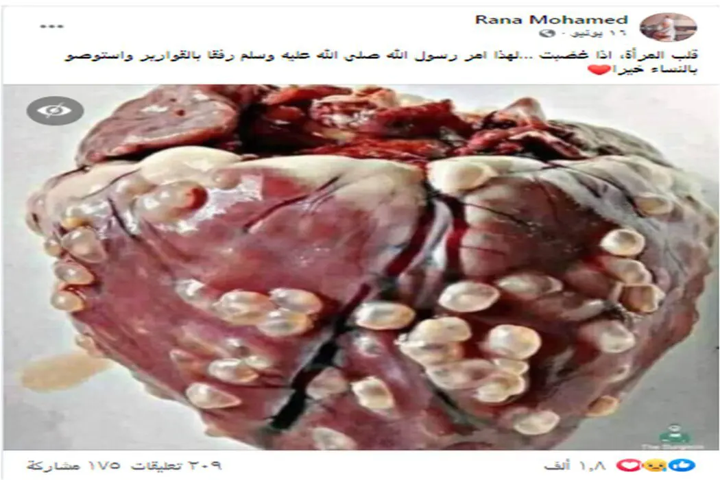 ادعاء قلب المرأة عندما تغضب