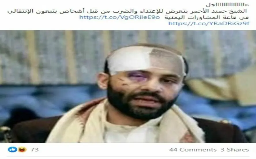 حميد الأحمر لم يتعرض للضرب