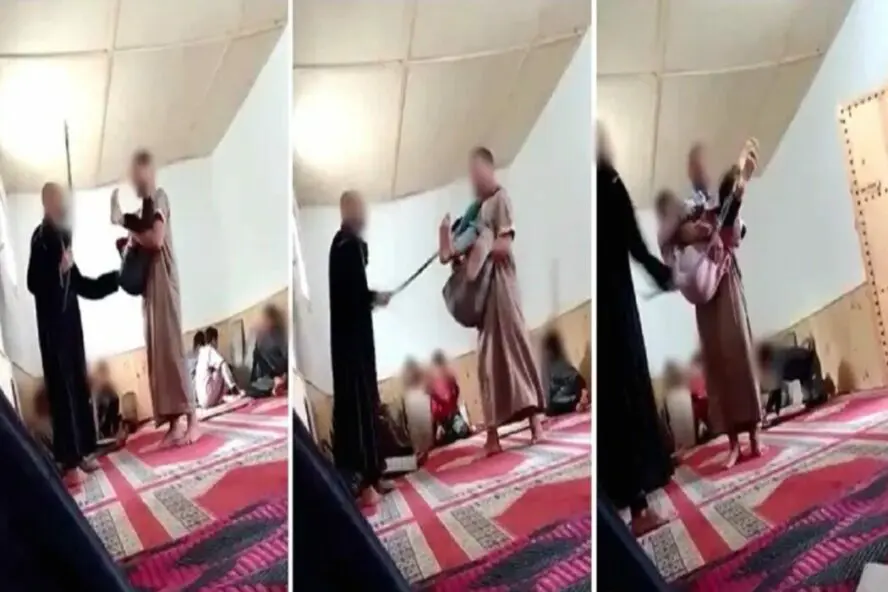 ادعاء ضرب طفل في اليمن