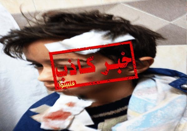 هذه الصورة لطفل تركي وليست لطفل مدينتي الذي تعرض لهجوم من الكلاب الشرسة