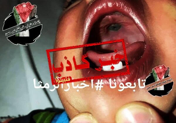 ليس برغي بل كباس بنطلون وضعه الطفل في فمه ولوجود أطراف للكباس علق في حلق الطفل