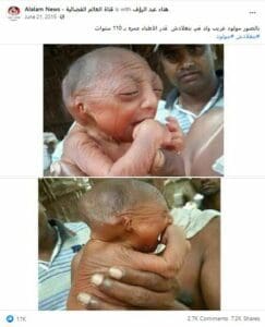 مصدر ادعاء ولادة طفل عمره 110 والصحيح أنه يعاني الشيخوخة المبكرة مضلل فتبينوا