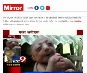موقع mirror يعرض حالة الطفلة فتبينوا