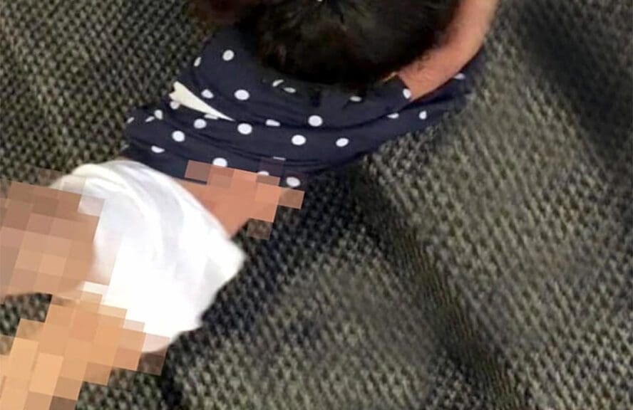 تعذيب الطفلة