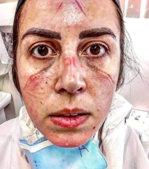 صورة تعود لممرضة برازيلية تدعى Amanda Ramalhoo