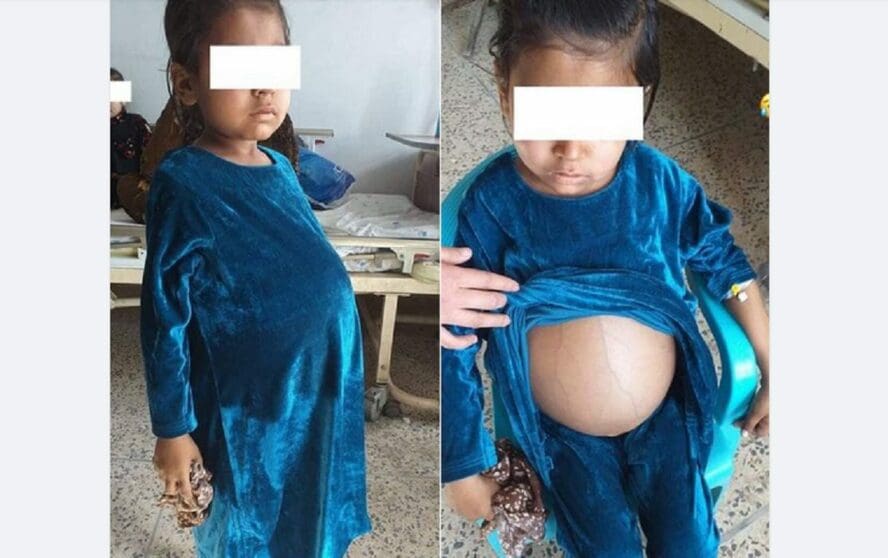 ادعاء طفلة حامل مضلل فتبينوا