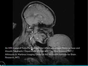 ادعاء قبلة الأم لطفلها في صورة الرنين المغناطيسي تظهر هرمون الدوبامين زائف جزئي صورة من جامعة MIT فتبينوا