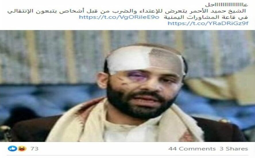 حميد الأحمر لم يتعرض للضرب