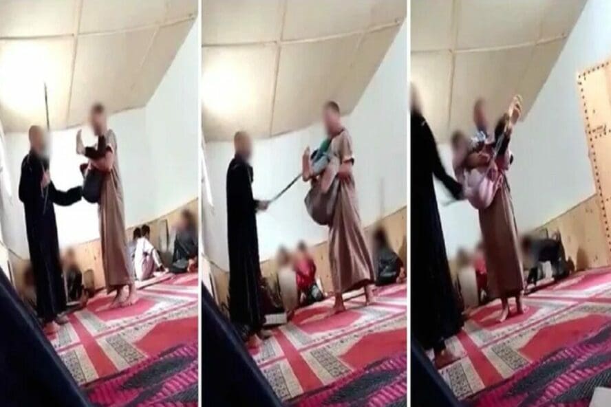 ادعاء ضرب طفل في اليمن